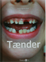 Tænder
